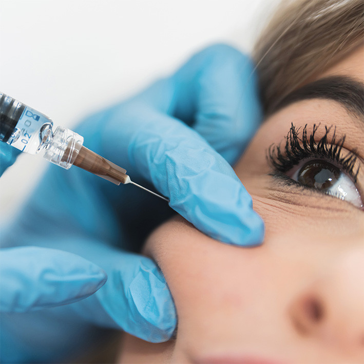 Cheek Filler